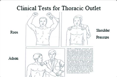 cervical compression test thoracic outlet syndrome|thoracic outlet syndrome physical exam.